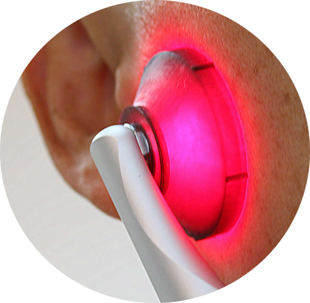 Fusion PBM fotobiomodulacja - obrazek 3